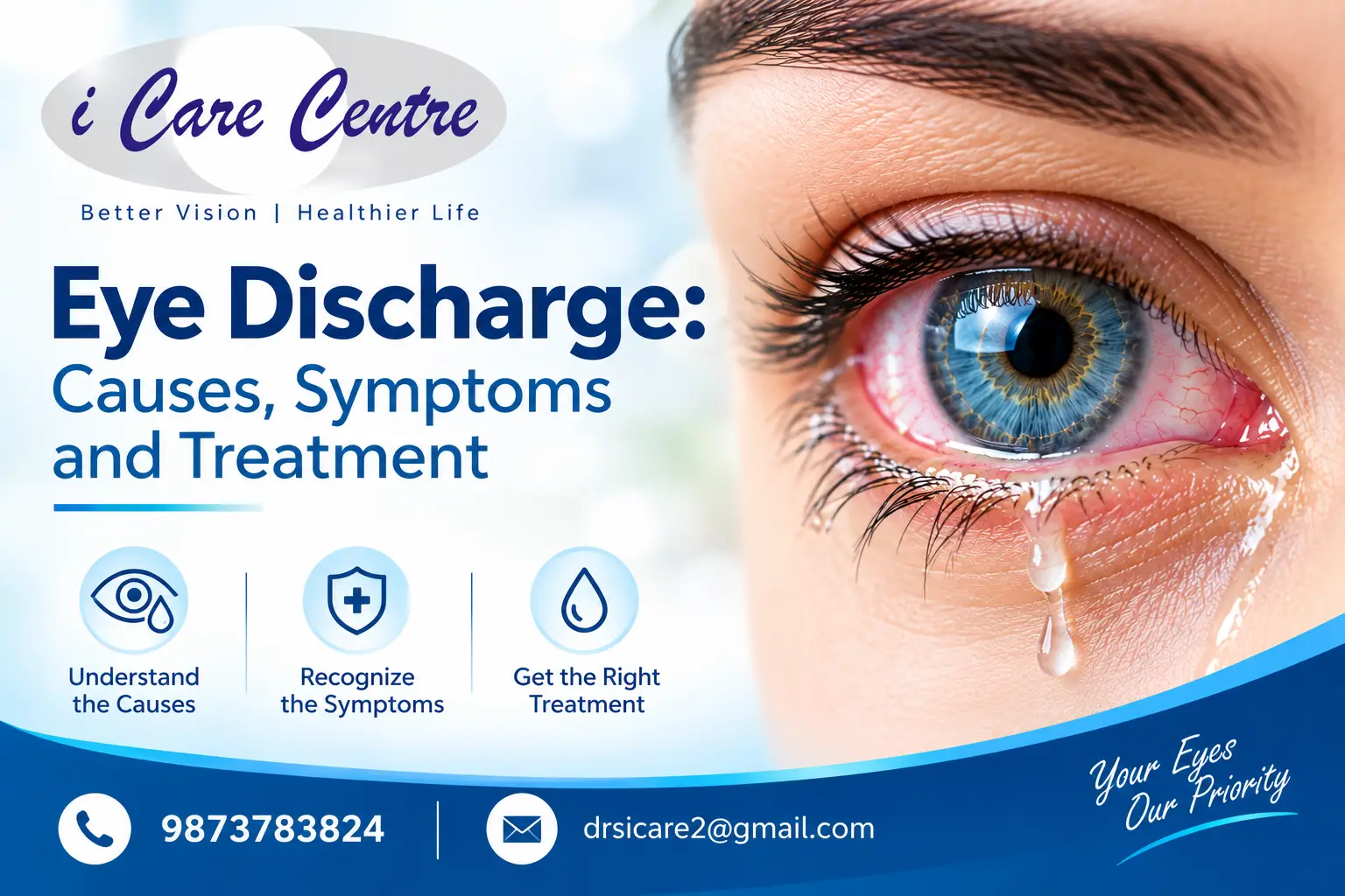 Eye Discharge